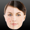 Perfect Face - Pimple Mole and Scar Remover App Icon