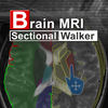 Brain MRI Sectional Walker App Icon