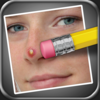 Pimple Eraser App Icon